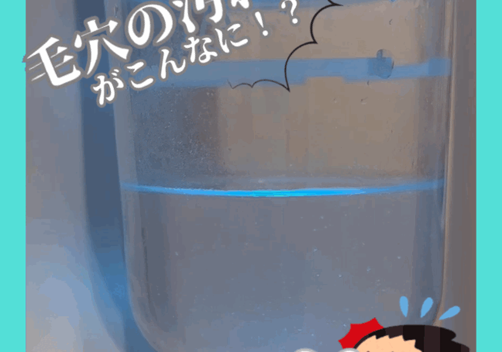 毛穴